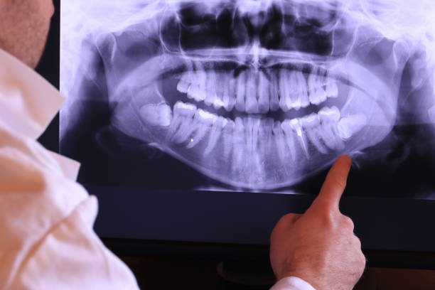 Best Emergency Dentist for Special Needs Patients in Whitestown, IN